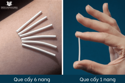 <a href="/thong-tin-suc-khoe2" title="Thông tin sức khỏe" rel="dofollow">Thông tin sức khỏe</a>