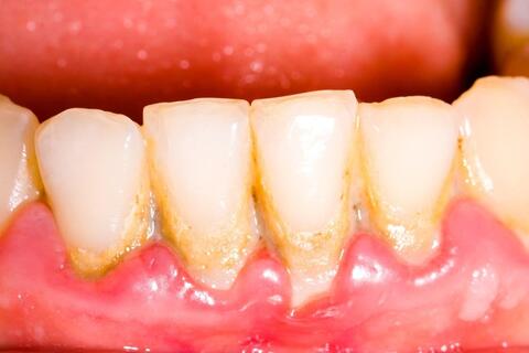 <a href="/thong-tin-suc-khoe2" title="Thông tin sức khỏe" rel="dofollow">Thông tin sức khỏe</a>